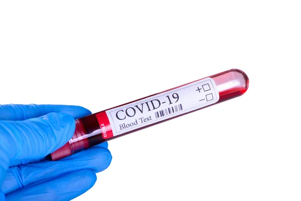 Covid Test Laboratory Sample Blood Testing Diagnosis Coronavirus Infection Hands — Stock Photo, Image