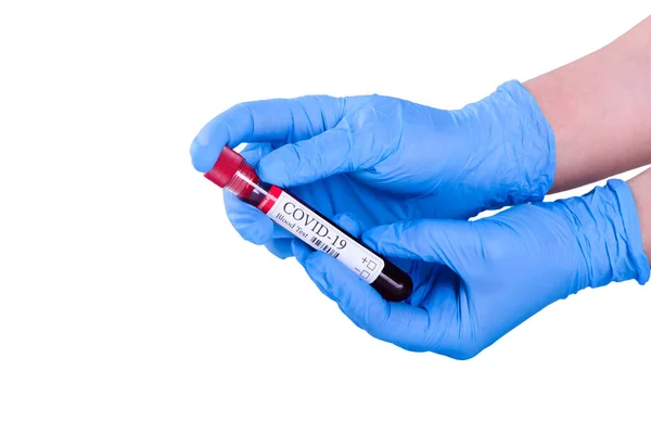 Covid Test Laboratoriummonster Van Bloedonderzoek Voor Diagnose Coronavirus Infectie Handen — Stockfoto