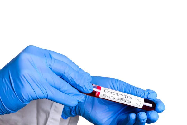 COVID-19 test and laboratory sample of blood testing for diagnosis coronavirus infection in the hands of the laboratory assistant isolated on white background and space for ads concept