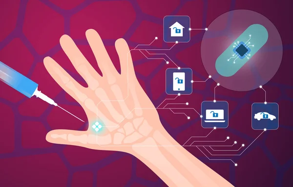 Menselijke microchip implantaat girosaldi vectorillustratie — Stockvector