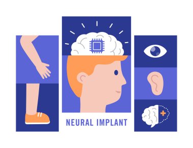 Sinirsel implantları düz vektör çizim tıbbi kavramı