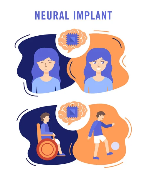 Implants neuronaux illustration vectorielle plate concept médical — Image vectorielle