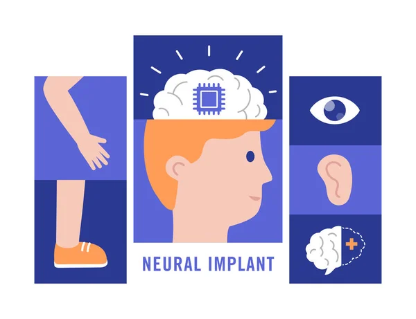 Neurale implantaten platte vector illustratie medische concept — Stockvector