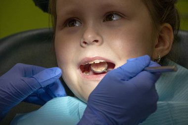 Küçük beyaz kız dişçide dişlerini tedavi ediyor.