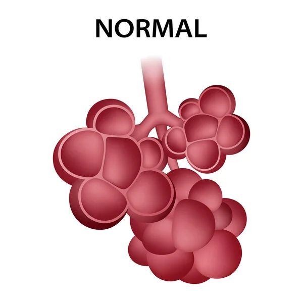 Icono de alvéolos sanos normales, estilo realista — Vector de stock