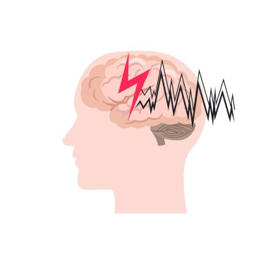 Beyaz bir arka plan üzerinde izole epilepsi simgesi. Vektör çizim.
