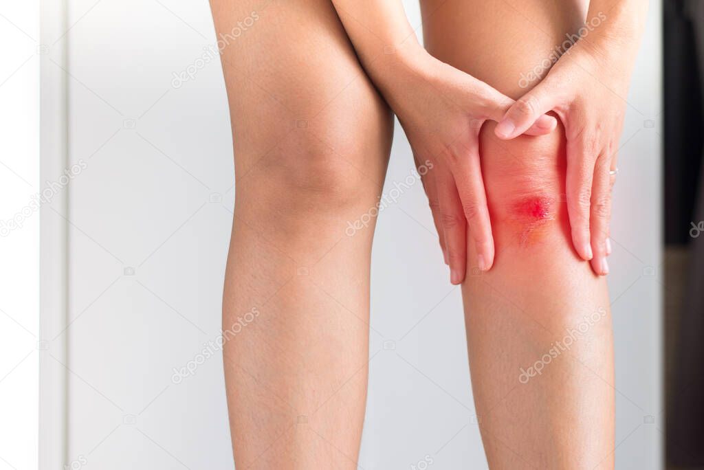 Woman suffering from bleeding wound on her knee,Scab becomes Infected