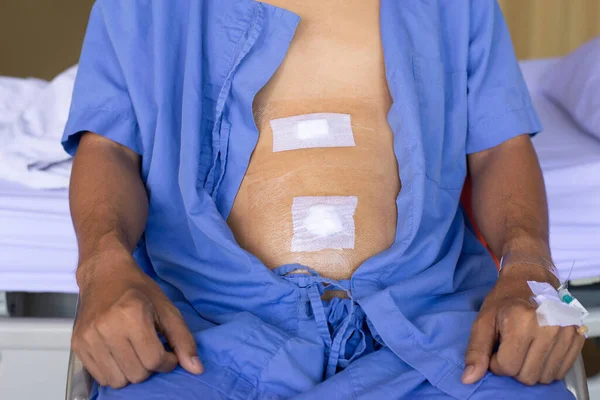 Patient man showing sticking plaster patched surgery wound on stomach after surgical