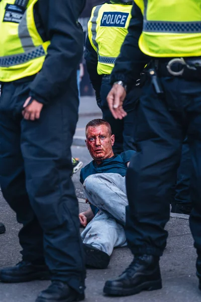 Londra / İngiltere - 06 / 13 / 2020: Siyahi Yaşamı Önemlidir protestosu koronavirüs salgını sırasında. Beyaz adamı koruyan polis memurları vahşi bir çete tarafından feci şekilde dövüldü.