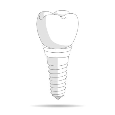 diş implantı logo, kutsal kişilerin resmi. İmplantasyon diş hekimliği ve diş bakım. illüstrasyon