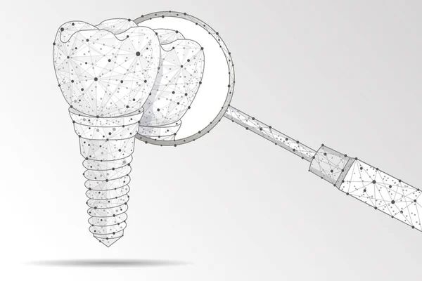 Clinique Dentaire Implant Dentaire Conception Polygonale Basse Poly Pour Affiche — Photo