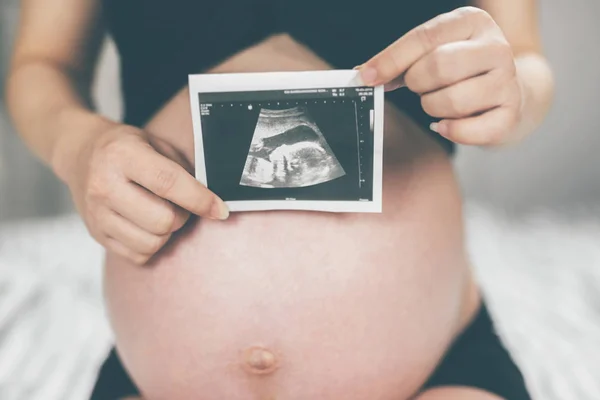 Zwangerschap Een Portret Van Een Paar Baby Kleine Schoenen Voor — Stockfoto