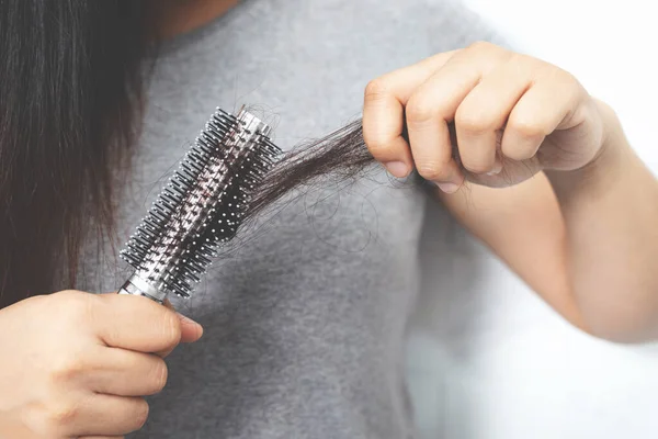 Mujeres Con Pérdida Cabello Porque Alérgica Champú — Foto de Stock