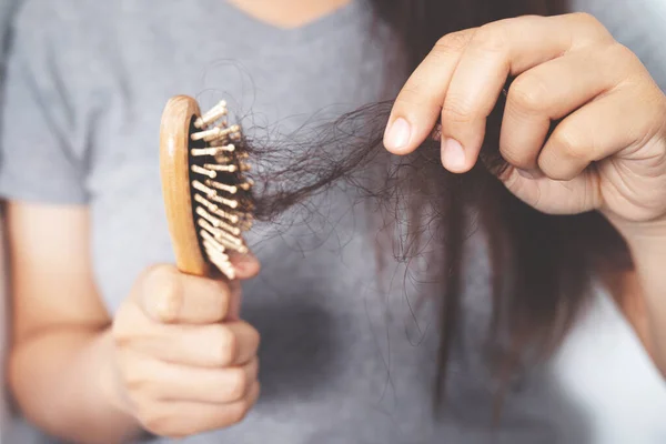Frauen Mit Haarausfall Weil Sie Allergisch Gegen Shampoo Ist — Stockfoto