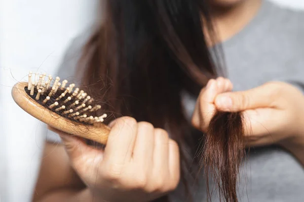 Las Mujeres Con Pérdida Cabello Ella Alérgica Champú — Foto de Stock