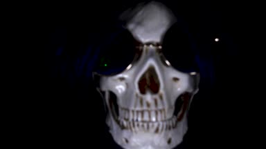 Kafatası siyah bir zemin üzerine yuvarlak güneş gözlüğü. yakın çekim. 4k, dolly shot, defocusing, bulanıklık.