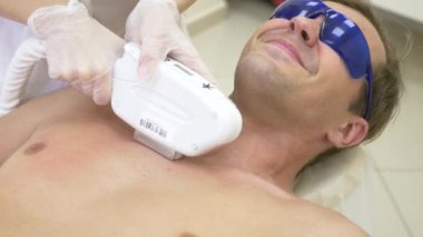 Erkek lazer epilasyon. Beyaz eldiven bir doktor karın ve göğüsler bir adamın saç kaldırır. 4k, yakın çekim. Ağır çekim