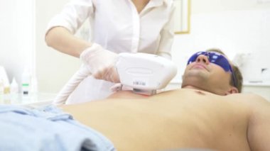 Erkek lazer epilasyon. Beyaz eldiven bir doktor karın ve göğüsler bir adamın saç kaldırır. 4k, yakın çekim. Ağır çekim