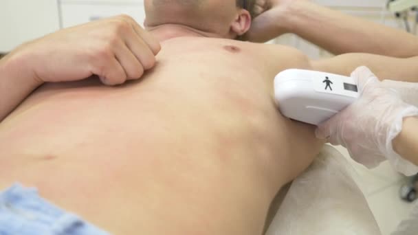 Männliche Laser-Haarentfernung. Ein Arzt in weißen Handschuhen entfernt einem Mann die Haare aus Bauch und Brüsten. 4k, Nahaufnahme. Zeitlupe — Stockvideo