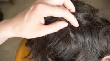 Yakın çekim. 4k, ağır çekim. Eller, üzerinde kahverengi saçlı kafa bitleri bulmak. pediculosis tedavisinde.