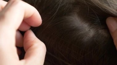 Yakın çekim. 4k, ağır çekim. Eller, üzerinde kahverengi saçlı kafa bitleri bulmak. pediculosis tedavisinde.