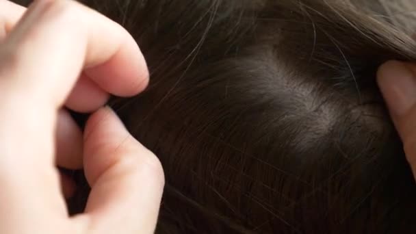 Yakın çekim. 4k, ağır çekim. Eller, üzerinde kahverengi saçlı kafa bitleri bulmak. pediculosis tedavisinde. — Stok video