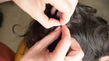Yakın çekim. 4k, ağır çekim. Eller, üzerinde kahverengi saçlı kafa bitleri bulmak. pediculosis tedavisinde.