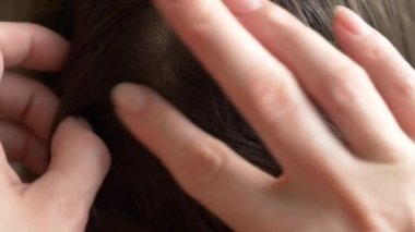 Yakın çekim. 4k, ağır çekim. Eller, üzerinde kahverengi saçlı kafa bitleri bulmak. pediculosis tedavisinde.