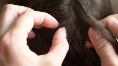 Yakın çekim. 4k, ağır çekim. Eller, üzerinde kahverengi saçlı kafa bitleri bulmak. pediculosis tedavisinde.