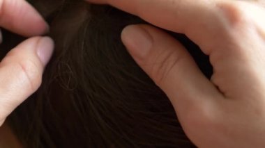 Yakın çekim. 4k, ağır çekim. Eller, üzerinde kahverengi saçlı kafa bitleri bulmak. pediculosis tedavisinde.