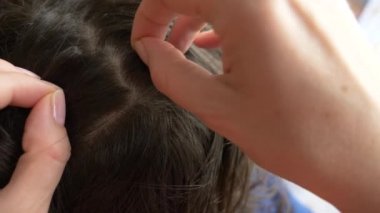 Yakın çekim. 4k, ağır çekim. Eller, üzerinde kahverengi saçlı kafa bitleri bulmak. pediculosis tedavisinde.