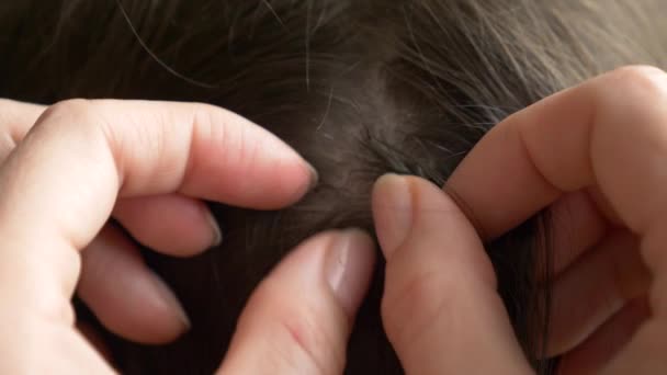 Gros plan. 4k, au ralenti. mains féminines, trouver des poux sur les têtes aux cheveux bruns. traitement de la pédiculose . — Video