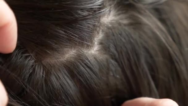 Close-up. 4k, slow motion. female hands, finding lice on heads with brown hair. treatment of pediculosis. — Stock Video