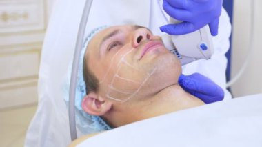 Sigara Cerrahi yüz germe. Smas ultrasonik kaldırma. Gençleştirme işlemidir. Donanım kozmetik. kontur yüz plastik. bir dermatolog Doktor elinde bir adam bir ultrason facelift olun.