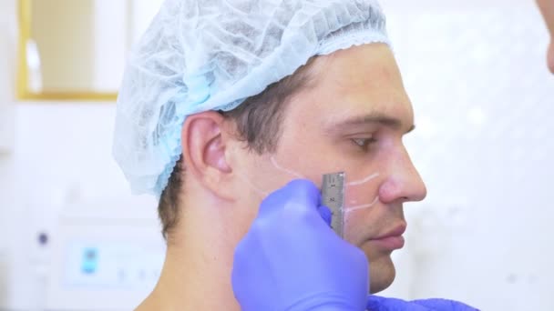 Mãos do doutor O cosmetologist faz marcações na cara do homem com um lápis. contorno de plástico rosto. 4K. Movimento lento — Vídeo de Stock