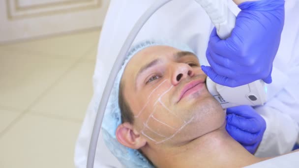 Πρόσωπο μη-χειρουργικά ανύψωσης. SMAS άρση υπερήχων. Η διαδικασία της αναζωογόνησης. Καλλυντικών υλικό. πλαστικό περιγράμματος προσώπου. τα χέρια του γιατρού δερματολόγου κάνουν έναν άνθρωπο ένα λίφτινγκ υπερήχων — Αρχείο Βίντεο