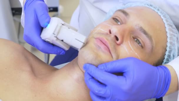 非外科的顔を持ち上げます。Smas は、超音波を持ち上げます。若返りのプロセス。ハードウェア美容。輪郭顔のプラスチック。皮膚科医師の手を作る男超音波美容整形 — ストック動画