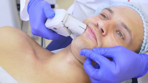 Lifting facial no quirúrgico. SMAS levantando ultrasonidos. El proceso de rejuvenecimiento. Cosmetología de hardware. contorno de cara de plástico. manos de un dermatólogo médico hacer un hombre un ultrasonido lifting facial — Vídeos de Stock