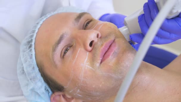 Levantamento facial não cirúrgico. SMAS levantando ultra-som. O processo de rejuvenescimento. Cosmetologia de hardware. contorno de plástico rosto. mãos de um dermatologista médico fazer um homem um ultra-som facelift — Vídeo de Stock