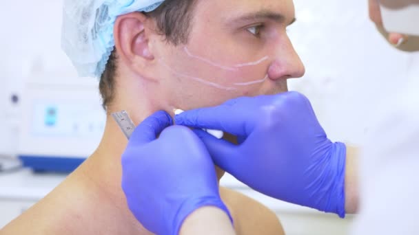 Rukou lékaře kosmetička je označení na tváři muže s tužkou. kontury obličeje plast. 4 k. Zpomalený pohyb — Stock video