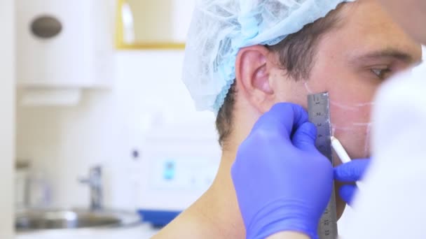 Rukou lékaře kosmetička je označení na tváři muže s tužkou. kontury obličeje plast. 4 k. Zpomalený pohyb — Stock video
