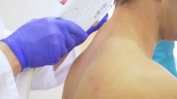 Depilación láser para hombre. el médico con guantes azules quita el pelo de los hombros y el cuello de un joven guapo. 4k, primer plano. Movimiento lento — Vídeo de stock