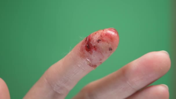 Крупным планом, палец на женской руке с порезом от ножа. 4K, замедленная съемка, зеленый фон . — стоковое видео