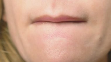 Süper yakın çekim, yavaş hareket, 4k. bir kadının dudakları ile dudak parlatıcısı boyuyor. Dudak makyaj, dermatolojik hastalık dudaklar cilt üzerinde. Tilki tilki granül