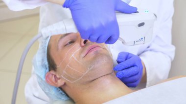 Sigara Cerrahi yüz germe. Smas ultrasonik kaldırma. Gençleştirme işlemidir. Donanım kozmetik. kontur yüz plastik. bir dermatolog Doktor elinde bir adam bir ultrason facelift olun.