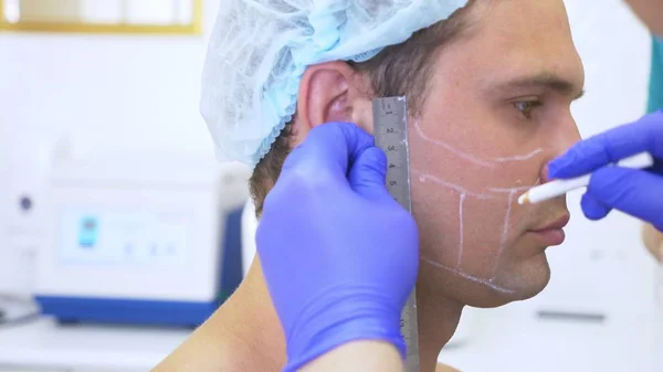 Manos del médico El cosmetólogo hace marcas en la cara del hombre con un lápiz. contorno de cara de plástico — Foto de Stock