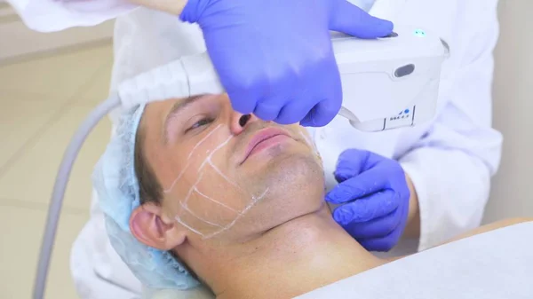 Lifting facial no quirúrgico. SMAS levantando ultrasonidos. El proceso de rejuvenecimiento. Cosmetología de hardware. contorno de cara de plástico. manos de un dermatólogo médico hacer un hombre un ultrasonido lifting facial — Foto de Stock