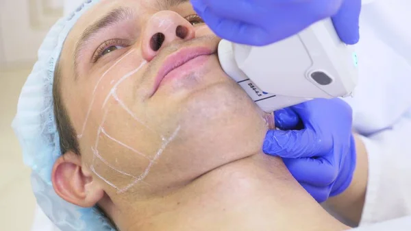 Lifting facial no quirúrgico. SMAS levantando ultrasonidos. El proceso de rejuvenecimiento. Cosmetología de hardware. contorno de cara de plástico. manos de un dermatólogo médico hacer un hombre un ultrasonido lifting facial — Foto de Stock