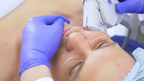 Lifting facial no quirúrgico. SMAS levantando ultrasonidos. El proceso de rejuvenecimiento. Cosmetología de hardware. contorno de cara de plástico. manos de un dermatólogo médico hacer un hombre un ultrasonido lifting facial — Foto de Stock