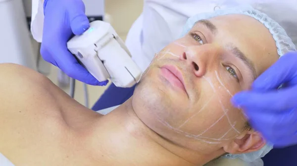 Non-surgical face lifting. SMAS lifting ultrasonic. The process of rejuvenation. Hardware cosmetology. contour face plastic. hands of a dermatologist doctor make a man an ultrasound facelift — Stock Photo, Image